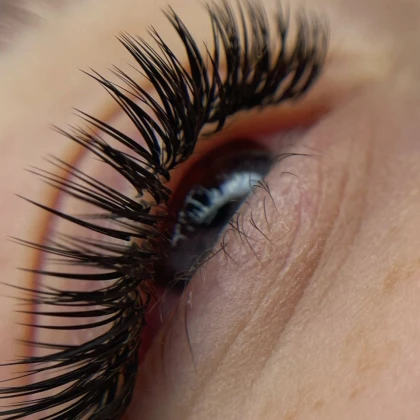 narashtivanie-resnits-v-brukline-photo