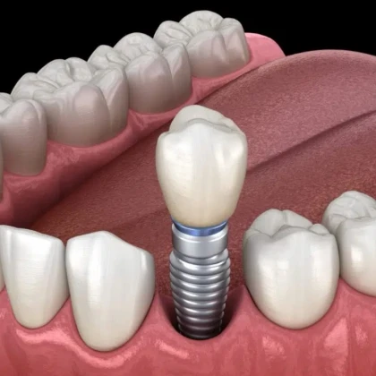 photo-ulibaytesy-s-uverennostyyu