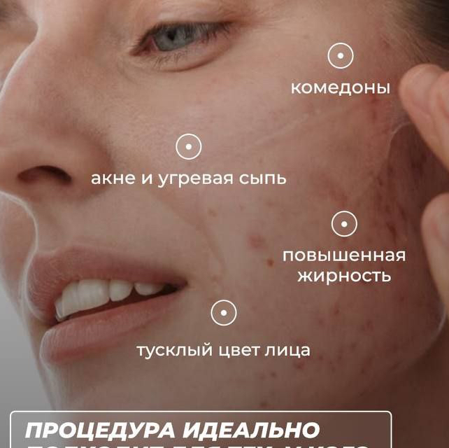 Приглашаю на косметологические процедуры . - Фото 4