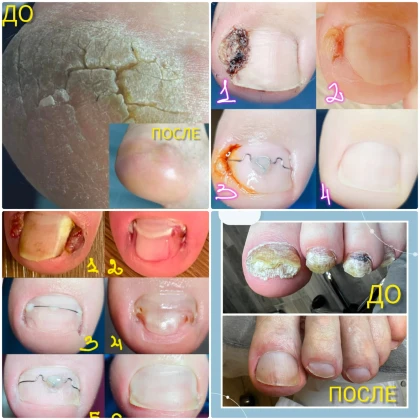 nataliya-uslugi-pedikyura-photo