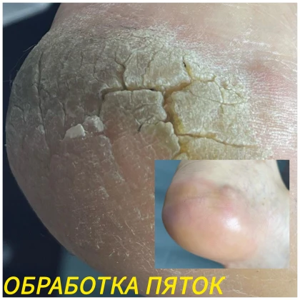 nataliya-uslugi-pedikyura-photo