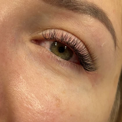 renton-naroshtennya-ta-lamnuvann-photo