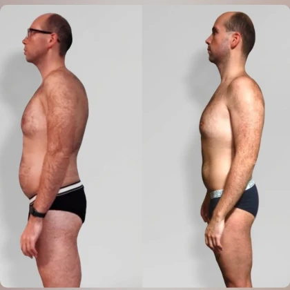 lechebniy-massazh-photo