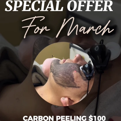 photo-spetsialynoe-predlozhenie-tolyko