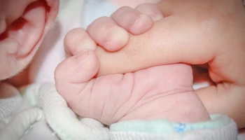 В Миссури родилась девочка без глаз